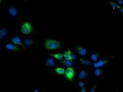 Immunocytochemistry/ Immunofluorescence: Cytochrome P450 2B6 Antibody (OTI3D5) - Azide and BSA Free [NBP2-70526]