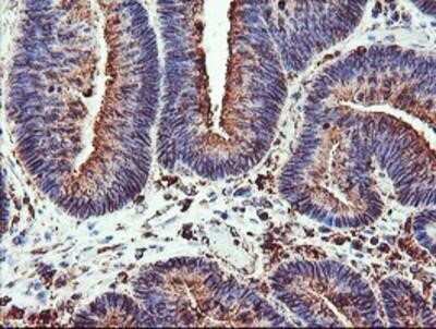 Immunohistochemistry: Cytochrome P450 2B6 Antibody (OTI3D5) - Azide and BSA Free [NBP2-70526]