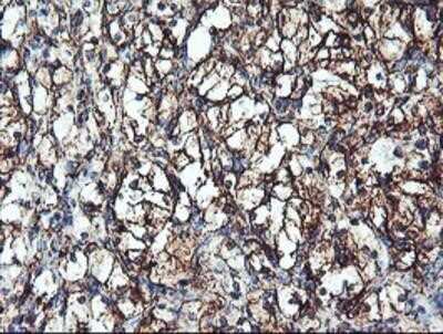 Immunohistochemistry: Cytochrome P450 2B6 Antibody (OTI3D5) - Azide and BSA Free [NBP2-70526]