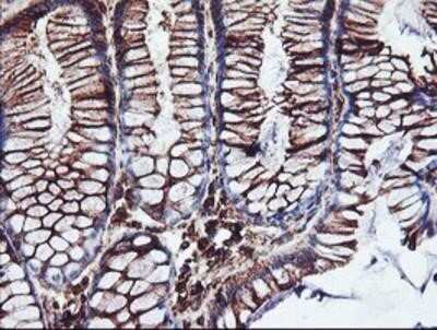 Immunohistochemistry: Cytochrome P450 2B6 Antibody (OTI3D5) - Azide and BSA Free [NBP2-70526]