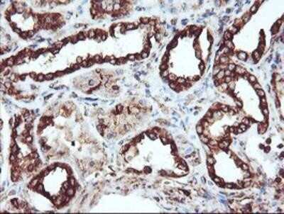 Immunohistochemistry: Cytochrome P450 2B6 Antibody (OTI3D5) - Azide and BSA Free [NBP2-70526]