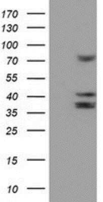 Western Blot: Cytochrome P450 2B6 Antibody (OTI3D5)Azide and BSA Free [NBP2-70526]