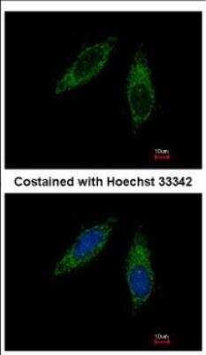 Immunocytochemistry/ Immunofluorescence: Cytochrome P450 2C8 Antibody [NBP2-16078]