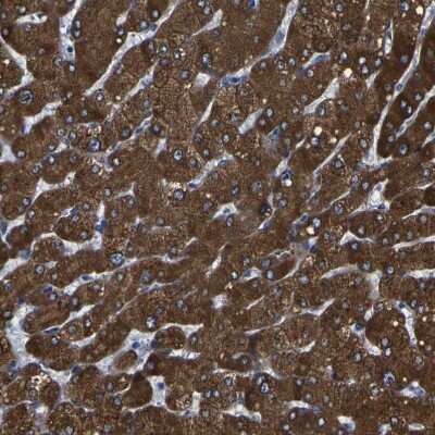 Immunohistochemistry-Paraffin: Cytochrome P450 2C8 Antibody [NBP1-88054]
