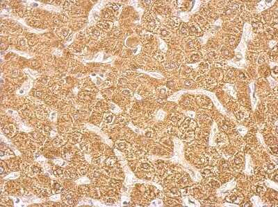 Immunohistochemistry-Paraffin: Cytochrome P450 2C8 Antibody [NBP2-16078]