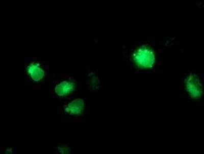 Immunocytochemistry/ Immunofluorescence: Cytochrome P450 2C9 Antibody (OTI1D7) - Azide and BSA Free [NBP2-70528]