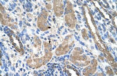 Immunohistochemistry-Paraffin: Cytochrome P450 2D6 Antibody [NBP1-62389]