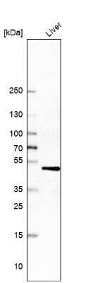 Western Blot: Cytochrome P450 2D6 Antibody [NBP1-91818]