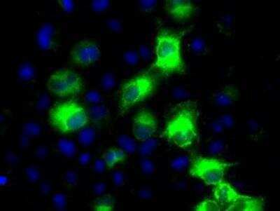 Immunocytochemistry/ Immunofluorescence: Cytochrome P450 2E1 Antibody (OTI5B9) [NBP2-02155]
