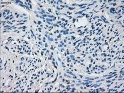 Immunohistochemistry: Cytochrome P450 2E1 Antibody (OTI5B9) - Azide and BSA Free [NBP2-70531]