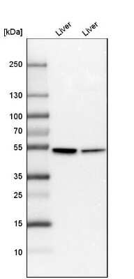 Western Blot: Cytochrome P450 2E1 Antibody [NBP1-85367]