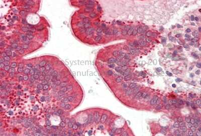 Immunohistochemistry: Cytochrome P450 3A5 Antibody [NBP1-68885]