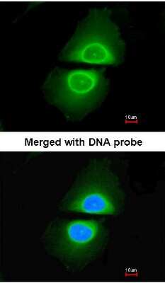 Immunocytochemistry/ Immunofluorescence: Cytochrome P450 4A Antibody [NBP1-31427]