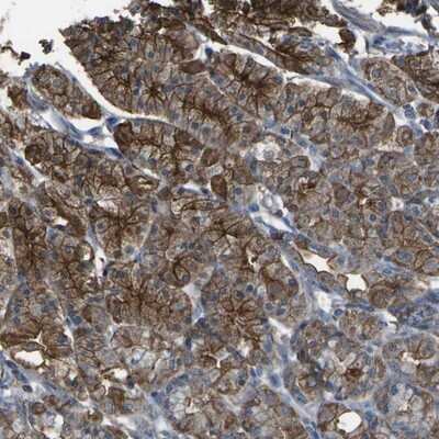 Immunohistochemistry-Paraffin: Cytochrome P450 4F11 Antibody [NBP1-87461]