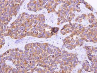 Immunohistochemistry-Paraffin: Cytochrome P450 4F11 Antibody [NBP2-16082]