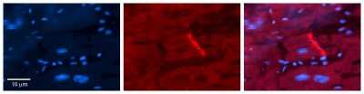 Immunohistochemistry: Cytochrome b245 alpha Antibody [NBP1-59573]