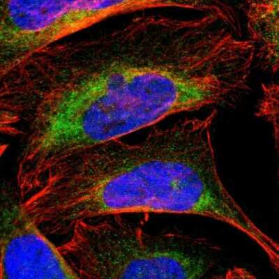 Immunocytochemistry/ Immunofluorescence: Cytochrome b5 Outer Mitochondrial Membrane Antibody [NBP1-88039]