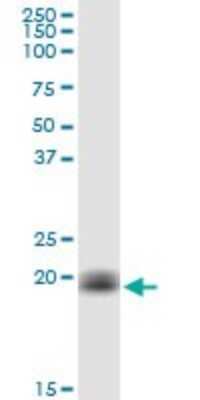 Western Blot: Cytochrome b5 Outer Mitochondrial Membrane Antibody [H00080777-B01P]