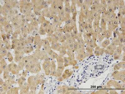 Immunohistochemistry-Paraffin: Cytochrome b5 type A Antibody (1A8) [H00001528-M06]