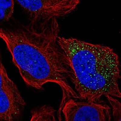 Immunocytochemistry/ Immunofluorescence: Cytochrome b5 type A Antibody [NBP2-49284]
