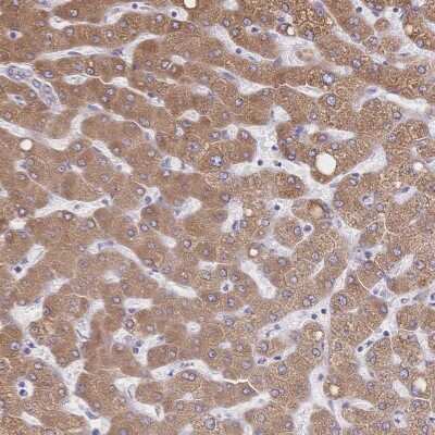 Immunohistochemistry-Paraffin: Cytochrome b5 type A Antibody [NBP2-49284]