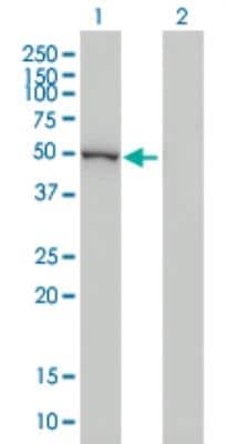 Western Blot: Cytochrome p450 2J2 Antibody (2D10) [H00001573-M01]
