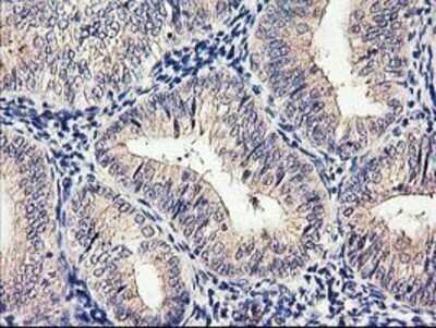 Immunohistochemistry: Cytochrome p450 2J2 Antibody (OTI5C5) - Azide and BSA Free [NBP2-70539]