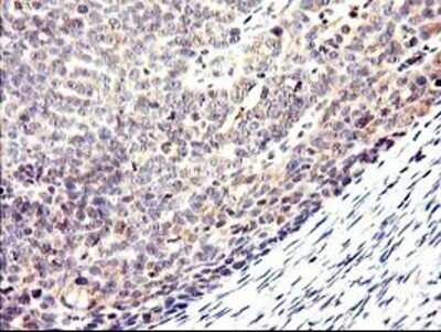 Immunohistochemistry: Cytochrome p450 2J2 Antibody (OTI5C5) - Azide and BSA Free [NBP2-70539]