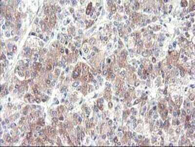 Immunohistochemistry: Cytochrome p450 2J2 Antibody (OTI5C5) - Azide and BSA Free [NBP2-70539]