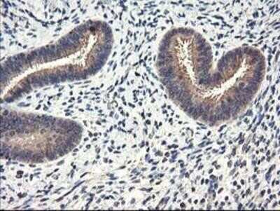 Immunohistochemistry-Paraffin: Cytochrome p450 2J2 Antibody (OTI5C5) [NBP2-01286]