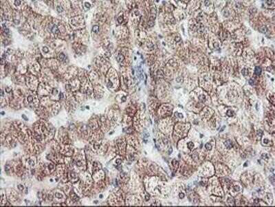 Immunohistochemistry-Paraffin: Cytochrome p450 2J2 Antibody (OTI5C5) [NBP2-01286]