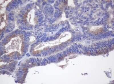 Immunohistochemistry: Cytochrome p450 2J2 Antibody (OTI5C9) - Azide and BSA Free [NBP2-70533]