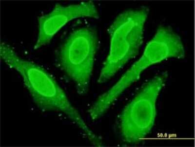Immunocytochemistry/ Immunofluorescence: Cytoglobin Antibody (1A1) [H00114757-M02]
