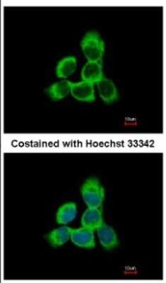 Immunocytochemistry/ Immunofluorescence: Cytoglobin Antibody [NBP2-16084]