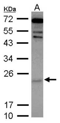 Western Blot: Cytoglobin Antibody [NBP2-16084]