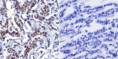 Immunohistochemistry-Paraffin: Cytohesin-1 Antibody (6G11) [NBP2-22513]