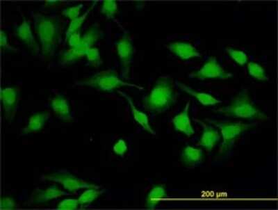 Immunocytochemistry/ Immunofluorescence: Cytohesin 2 Antibody (6H5) [H00009266-M02]