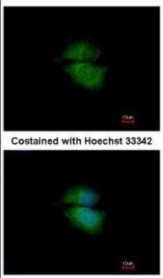 Immunocytochemistry/ Immunofluorescence: Cytohesin 3 Antibody [NBP2-16085]