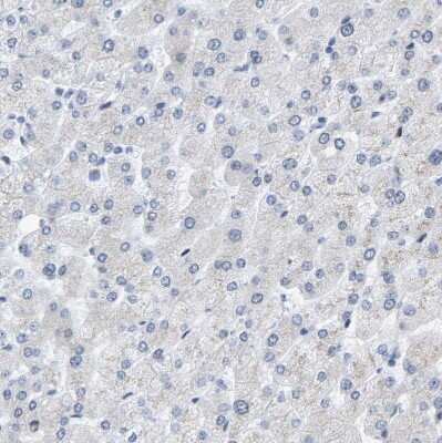 Immunohistochemistry-Paraffin: Cytokeratin, HMW Antibody [NBP1-81648]
