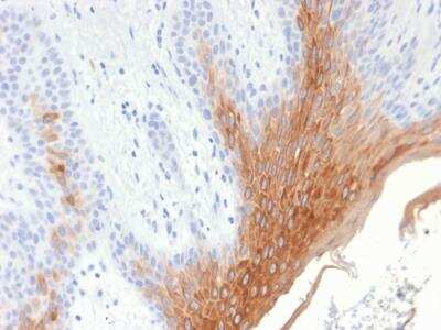 Immunohistochemistry-Paraffin: Cytokeratin 10 Antibody (KRT10/1990R) - Azide and BSA Free [NBP2-75768]