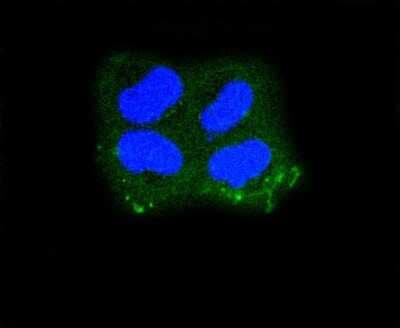 Immunocytochemistry/ Immunofluorescence: Cytokeratin 1/10 Antibody (ST05-43) [NBP2-67544]