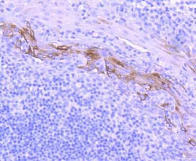 Immunohistochemistry-Paraffin: Cytokeratin 1/10 Antibody (ST05-43) [NBP2-67544]
