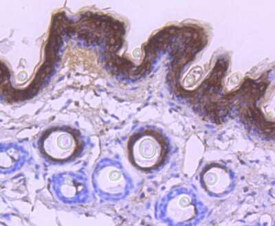 Immunohistochemistry-Paraffin: Cytokeratin 1/10 Antibody (ST05-43) [NBP2-67544]