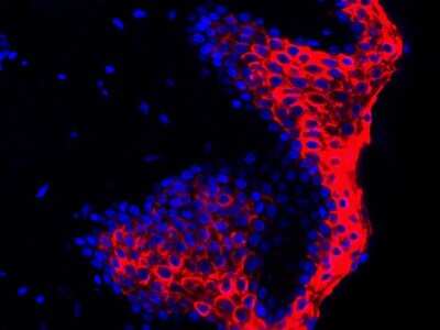 Immunohistochemistry-Paraffin: Cytokeratin 1/10 Antibody (ST05-43) [NBP2-67544]