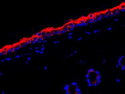 Immunohistochemistry-Paraffin: Cytokeratin 1/10 Antibody (ST05-43) [NBP2-67544]