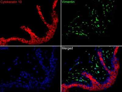 Immunohistochemistry-Paraffin: Cytokeratin 1/10 Antibody (ST05-43) [NBP2-67544]