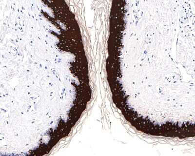 Immunohistochemistry-Paraffin: Cytokeratin 1/10 Antibody (ST05-43) [NBP2-67544]