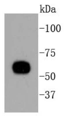 Western Blot: Cytokeratin 1/10 Antibody (ST05-43) [NBP2-67544]
