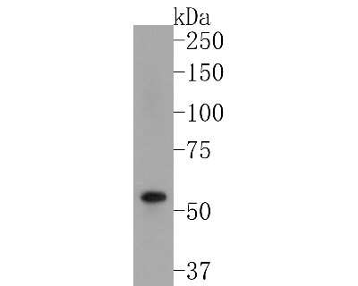Western Blot: Cytokeratin 1/10 Antibody (ST05-43) [NBP2-67544]