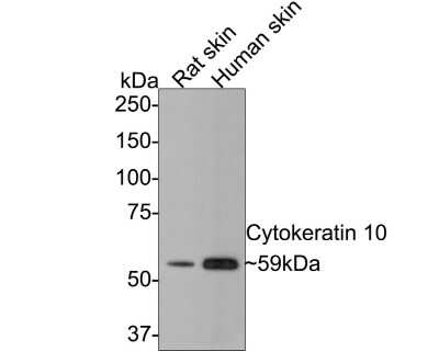 Western Blot: Cytokeratin 1/10 Antibody (ST05-43) [NBP2-67544]
